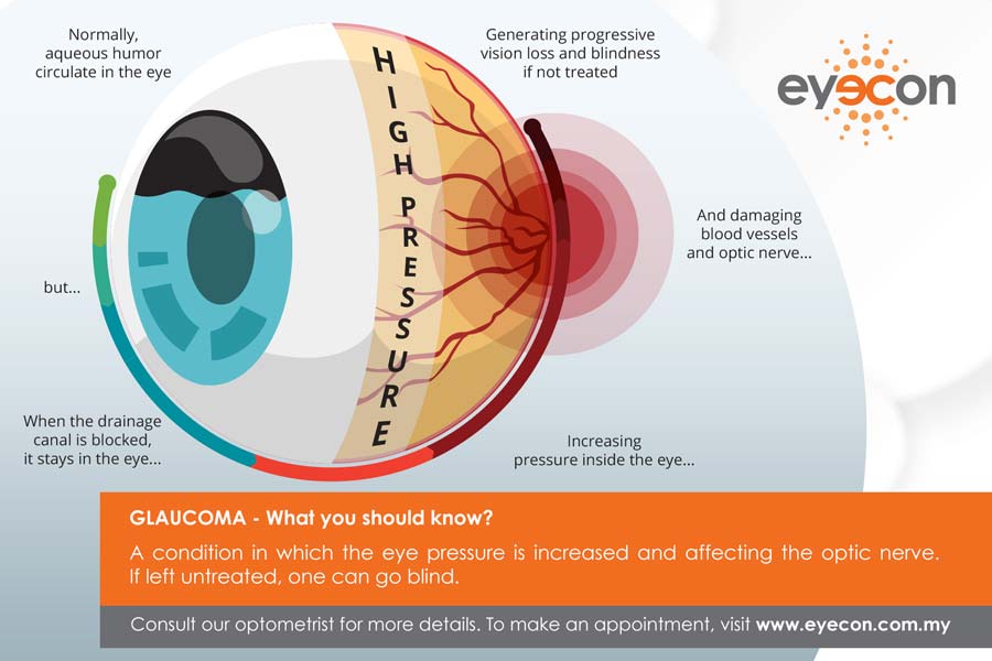 Eye Disease - Glaucoma